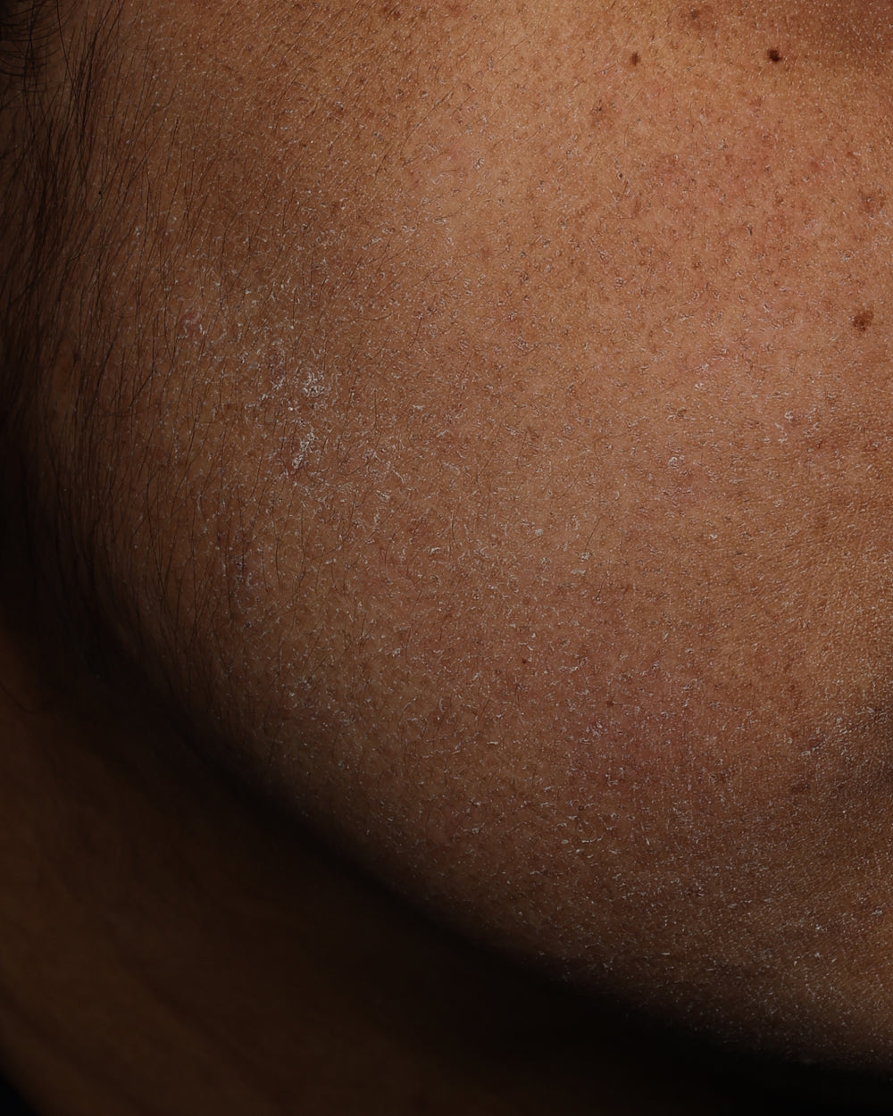 Flout | Clinical Pro-Ageing Skincare for Indian Skin Longevity